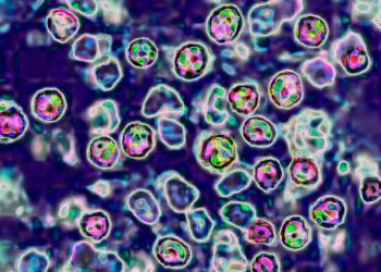 European region sees highest number of measles cases in 25 years, WHO says