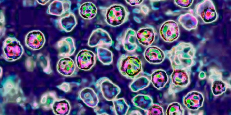 European region sees highest number of measles cases in 25 years, WHO says